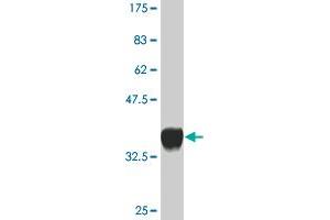 Western Blot detection against Immunogen (36. (PPOX antibody  (AA 378-477))