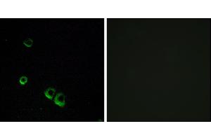 Immunofluorescence analysis of MCF-7 cells, using AVPR2 antibody. (AVPR2 antibody)