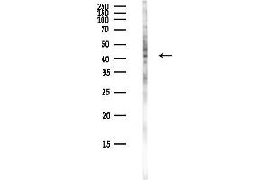anti-Protein Geranylgeranyltransferase Type I, beta Subunit (PGGT1B) antibody