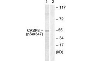Western blot analysis of extracts from Jurkat cells, using Caspase 8 (Phospho-Ser347) Antibody. (Caspase 8 antibody  (pSer347))