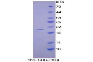 SDS-PAGE analysis of Human DISC1 Protein.