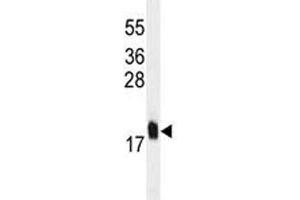 MCFD2 antibody western blot analysis in U251 lysate.