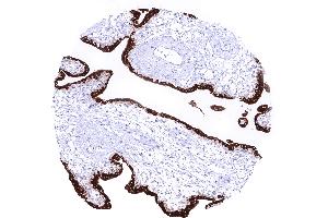 First trimenon placenta showing an intense cytoplasmic KISS1 staining of syncytiotrophoblast cells