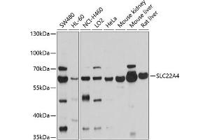 Western blot analysis of extracts of various cell lines, using SLC22 antibody (ABIN6128768, ABIN6147890, ABIN6147891 and ABIN6214765) at 1:1000 dilution. (SLC22A4 antibody  (AA 42-141))