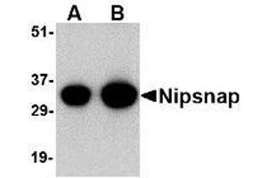 Image no. 1 for anti-4-Nitrophenylphosphatase Domain and Non-Neuronal SNAP25-Like Protein Homolog 1 (NIPSNAP1) (C-Term) antibody (ABIN1492169) (NIPSNAP1 antibody  (C-Term))