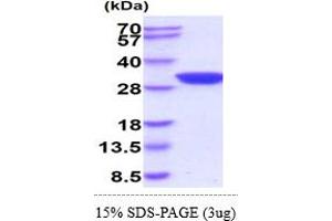 SDS-PAGE (SDS) image for Adenylate Kinase 2 (AK2) (AA 1-239) (Active) protein (His tag) (ABIN5855039) (Adenylate Kinase 2 Protein (AK2) (AA 1-239) (His tag))