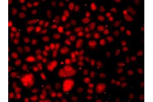 Immunofluorescence analysis of A549 cells using RELA antibody. (NF-kB p65 antibody)