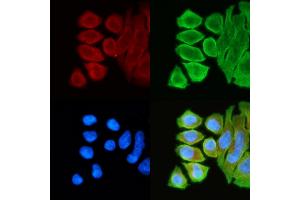 ABIN6261558 and ABIN6268802 staining Hela cells(30 min of UV treatment) by IF/ICC.