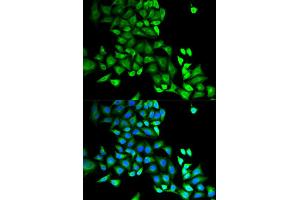 Immunofluorescence (IF) image for anti-GDP Dissociation Inhibitor 1 (GDI1) antibody (ABIN1876650) (GDI1 antibody)