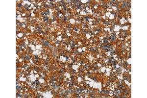 Immunohistochemistry of Human brain  using COX5A Polyclonal Antibody at dilution of 1:40