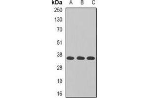 Western blot analysis of TAMM41 expression in MCF7 (A), K562 (B), Jurkat (C) whole cell lysates. (TAM41 antibody)