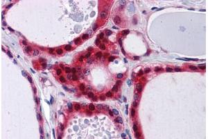 Human Thyroid: Formalin-Fixed, Paraffin-Embedded (FFPE) (PCBP2 antibody  (AA 1-363))
