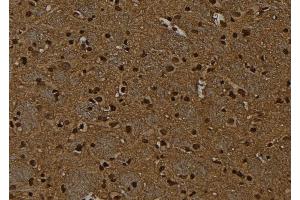 ABIN6267090 at 1/100 staining Rat brain tissue by IHC-P. (RUNX1 antibody  (pSer249))