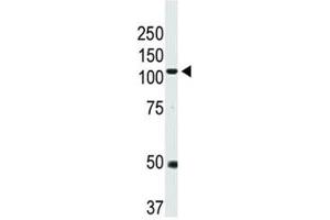 Western blot analysis of BMPR2 antibody and mouse heart tissue lysate (BMPR2 antibody  (AA 28-59))