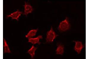ABIN6272358 staining MCF7 by IF/ICC. (NEURL antibody  (Internal Region))