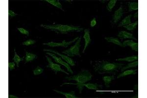 Immunofluorescence of monoclonal antibody to MCFD2 on HeLa cell. (MCFD2 antibody  (AA 1-146))