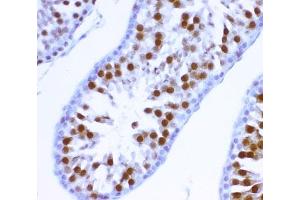 IHC-P: MCAK antibody testing of rat testis tissue (KIF2C antibody  (AA 531-725))