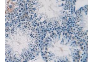 Detection of SDF1 in Mouse Testis Tissue using Polyclonal Antibody to Stromal Cell Derived Factor 1 (SDF1) (CXCL12 antibody  (AA 22-89))
