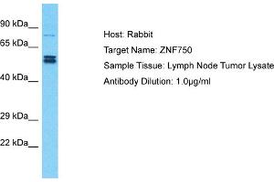 Host: Rabbit Target Name: ZNF750 Sample Type: Lymph Node Tumor lysates Antibody Dilution: 1. (ZNF750 antibody  (N-Term))