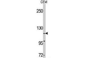 Western blot analysis of TNK2 polyclonal antibody  in CEM cell line lysates (35 ug/lane). (TNK2 antibody  (C-Term))