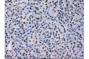 Immunohistochemical staining of paraffin-embedded pancreas tissue using anti-MAPK12mouse monoclonal antibody. (MAPK12 antibody)