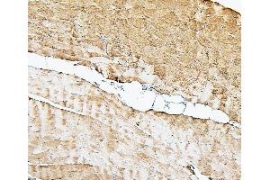 IHC analysis of Cofilin-2 using anti-Cofilin-2 antibody (ABIN7602747). (Cofilin 2 antibody  (C-Term))