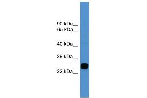WB Suggested Anti-UCHL1 Antibody Titration: 0. (UCHL1 antibody  (C-Term))