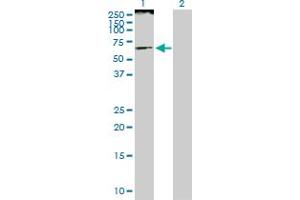 Western Blot analysis of SMARCE1 expression in transfected 293T cell line by SMARCE1 MaxPab polyclonal antibody. (SMARCE1 antibody  (AA 1-411))