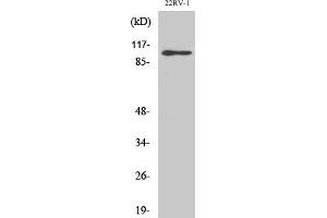 anti-Glutamate Receptor, Ionotropic, AMPA 2 (GRIA2) antibody