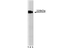 Western Blotting (WB) image for anti-Tight Junction Protein 1 (TJP1) (AA 1048-1247) antibody (ABIN968283) (TJP1 antibody  (AA 1048-1247))