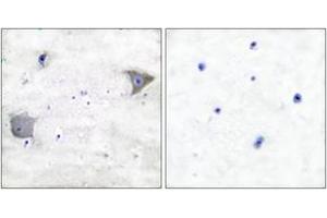 Immunohistochemistry (IHC) image for anti-Platelet Derived Growth Factor Receptor alpha (PDGFRA) (AA 1031-1080) antibody (ABIN2889249) (PDGFRA antibody  (AA 1031-1080))