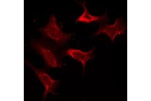 ABIN6278601 staining COLO205 by IF/ICC. (OR10X1 antibody  (Internal Region))
