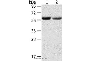 Western blot analysis of Human normal stomach and stomach cancer tissue, using SLC16A9 Polyclonal Antibody at dilution of 1:200 (SLC16A9 antibody)
