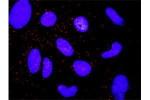 Proximity Ligation Analysis of protein-protein interactions between ARRB2 and CTNNA1. (CTNNA1 antibody  (AA 152-250))