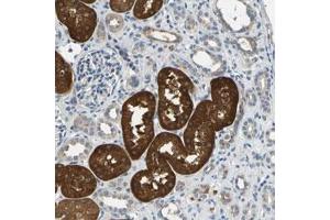 Immunohistochemical staining (Formalin-fixed paraffin-embedded sections) of human kidney with IL17RB polyclonal antibody  shows strong cytoplasmic positivity in tubular cells. (IL17 Receptor B antibody)