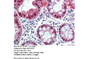 Immunohistochemistry with Human Colon lysate tissue at an antibody concentration of 5. (SCML1 antibody  (Middle Region))