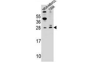 IFI6 Antibody (N-term) western blot analysis in MDA-MB453,CEM cell line lysates (35µg/lane). (IFI6 antibody  (N-Term))