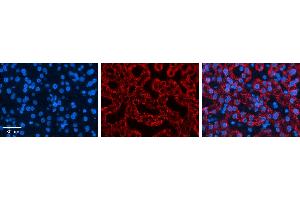 CTAGE5 antibody - middle region          Formalin Fixed Paraffin Embedded Tissue:  Human Liver Tissue    Observed Staining:  Cytoplasm in hepatocytes   Primary Antibody Concentration:  1:600    Secondary Antibody:  Donkey anti-Rabbit-Cy3    Secondary Antibody Concentration:  1:200    Magnification:  20X    Exposure Time:  0.