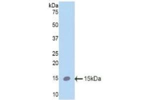 Detection of Recombinant SPC, Mouse using Polyclonal Antibody to Surfactant Protein C (SP-C) (Surfactant Protein C antibody  (AA 94-193))
