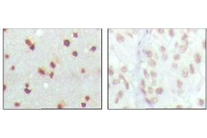 Immunohistochemical analysis of paraffin-embedded human cerebra (left) and lung carcinoma (right) tissues, showing nuclear localization with DAB staining using MDM4 mouse mAb.