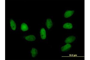 Immunofluorescence of purified MaxPab rabbit antibody to CBX5 on HeLa cell. (CBX5 antibody  (AA 1-191))