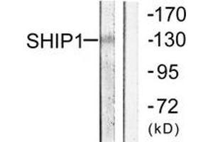 Western blot analysis of extracts from mouse brain cells, using SHIP1 (Ab-1020) Antibody.