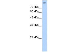 ALOX15B antibody used at 2. (ALOX15B antibody  (C-Term))
