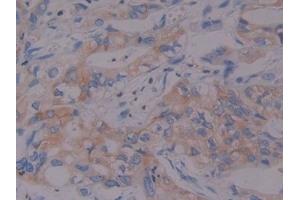 Immunohistochemistry (IHC) image for anti-Prothrombin Fragment 1+2 (F1+2) antibody (ABIN7437446)