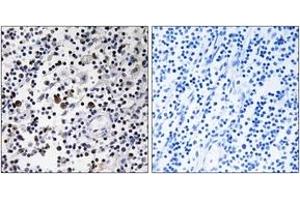 Immunohistochemistry analysis of paraffin-embedded human lymph node tissue, using CD302 Antibody. (DCL1 antibody  (AA 51-100))