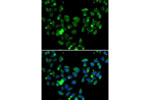 Immunofluorescence analysis of A549 cells using CARD11 antibody (ABIN5974295).