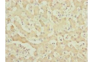 Immunohistochemistry of paraffin-embedded human liver tissue using ABIN7174957 at dilution of 1:100 (MYO5B antibody  (AA 1440-1690))