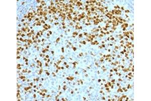 IHC testing of FFPE human tonsil with Topoisomerase II alpha antibody (clone TPM2A-2). (Topoisomerase II alpha antibody)