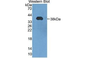 Western blot analysis of the recombinant protein. (HSF4 antibody  (AA 91-407))