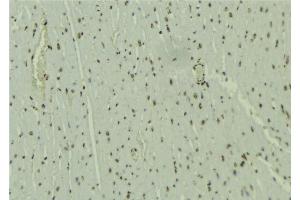 ABIN6277652 at 1/100 staining Mouse muscle tissue by IHC-P. (WHSC1L1 antibody  (N-Term))